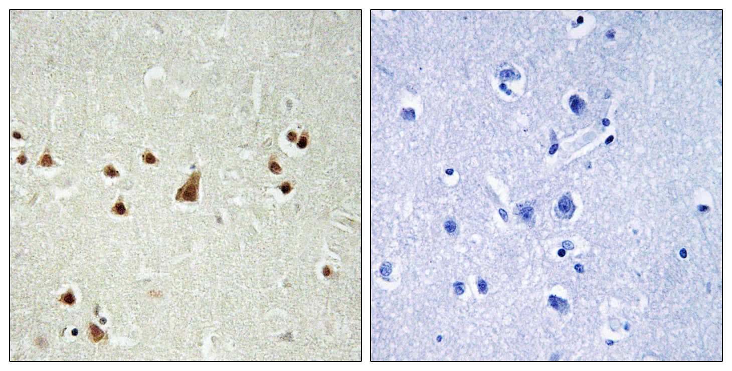 ANKRD26 Antibody (aa791-840)