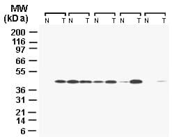 CARD8 / Cardinal / TUCAN Antibody (aa125-146)