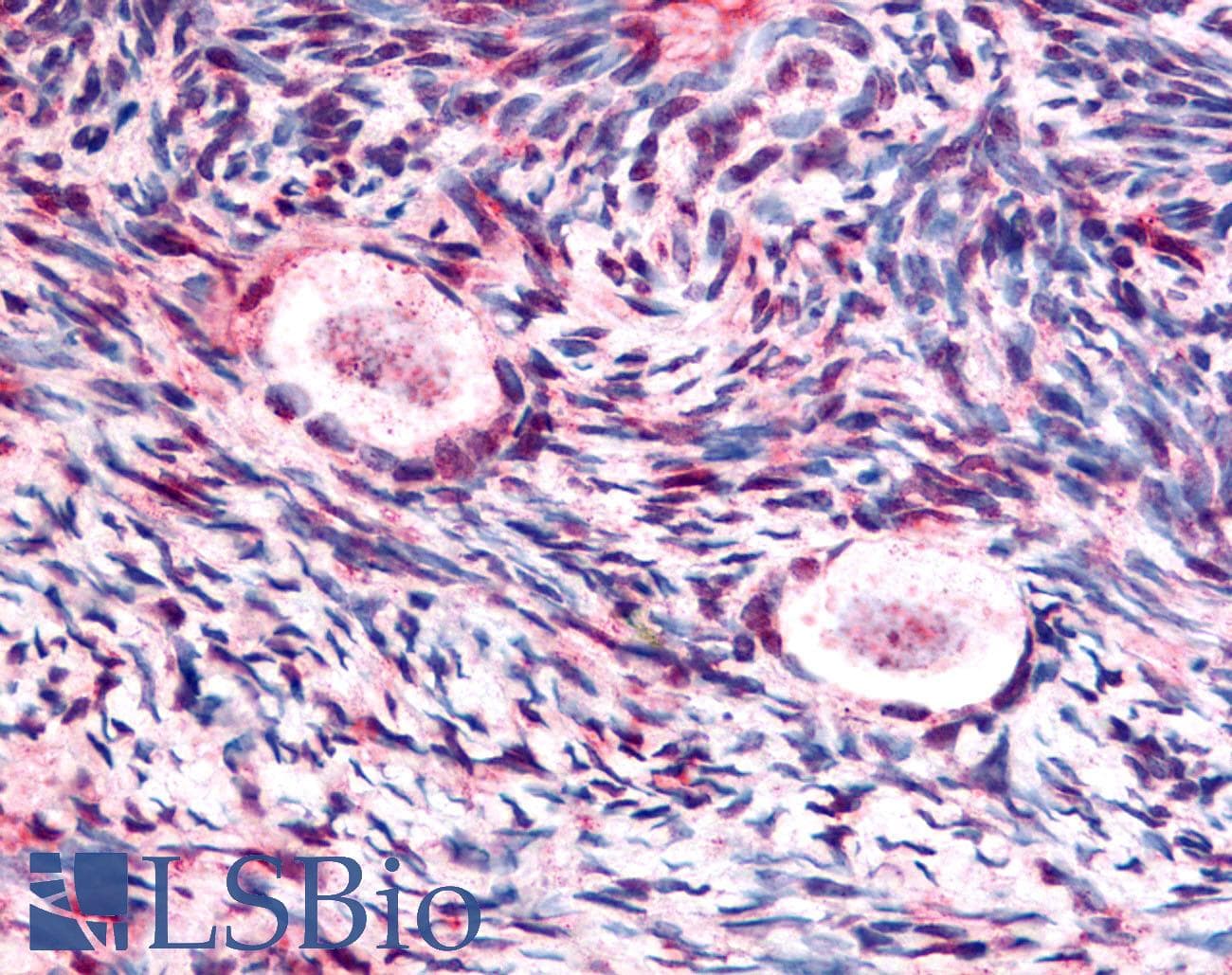 IHC-plus™ GSK3B / GSK3 Beta Antibody (phospho-Ser9)