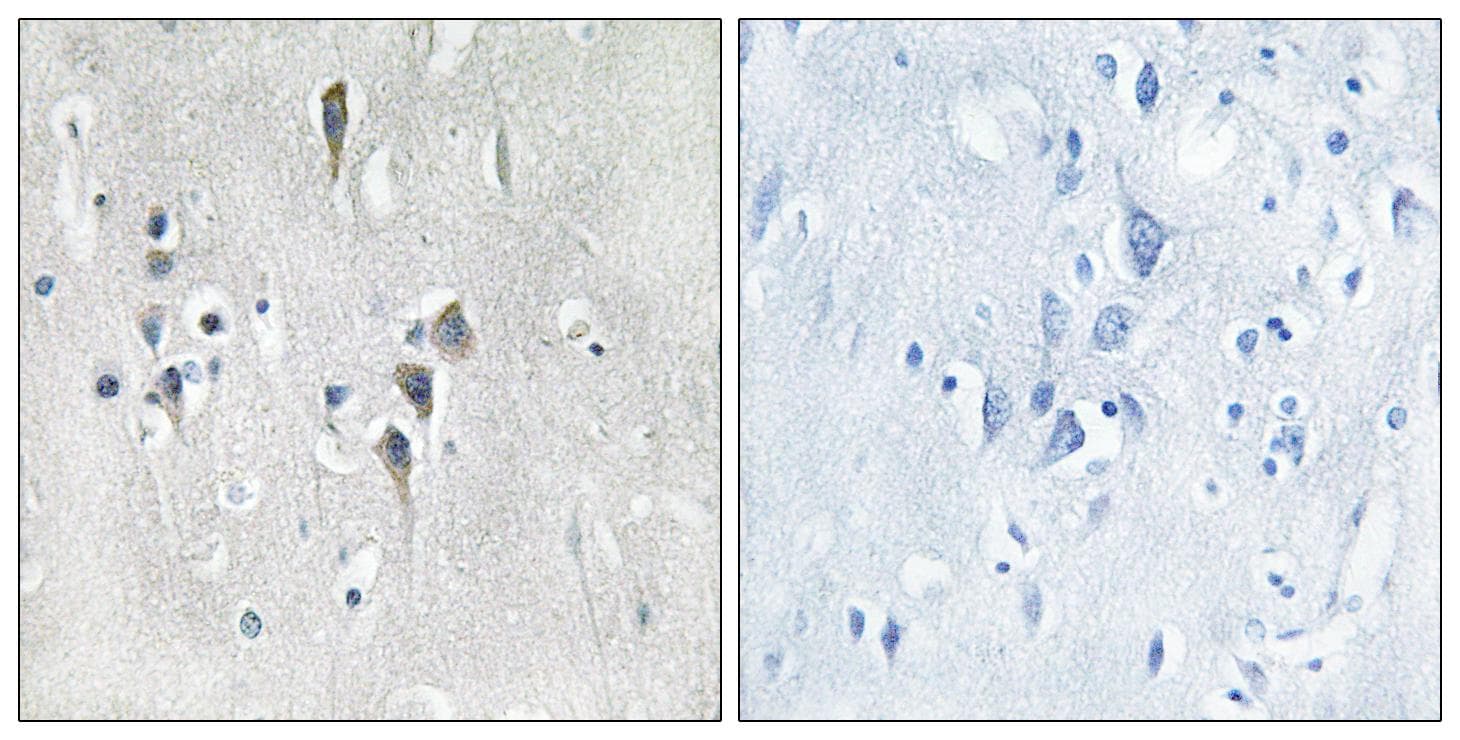 CaMKII Alpha+Delta Antibody (Ab-286)