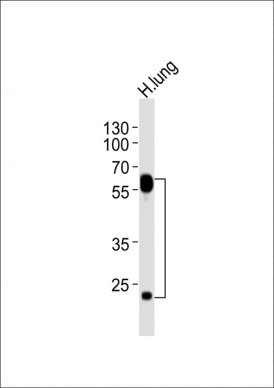 FLT1 / VEGFR1 Antibody (clone 1453CT519.277.79)
