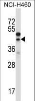 CTGF Antibody (aa166-193)