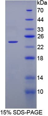 Sheep FGF1 / Acidic FGF Protein (Recombinant His-T7)