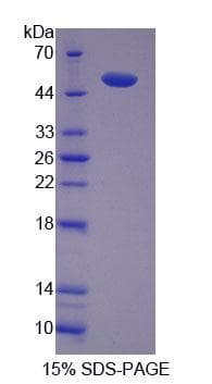 Mouse SKAP1 / SCAP1 Protein (Recombinant His-T7, N-terminus)