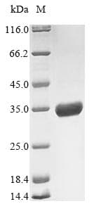 Rotavirus A Outer Capsid Protein VP4 (Recombinant 10His, N-terminus + Myc, C-terminus)