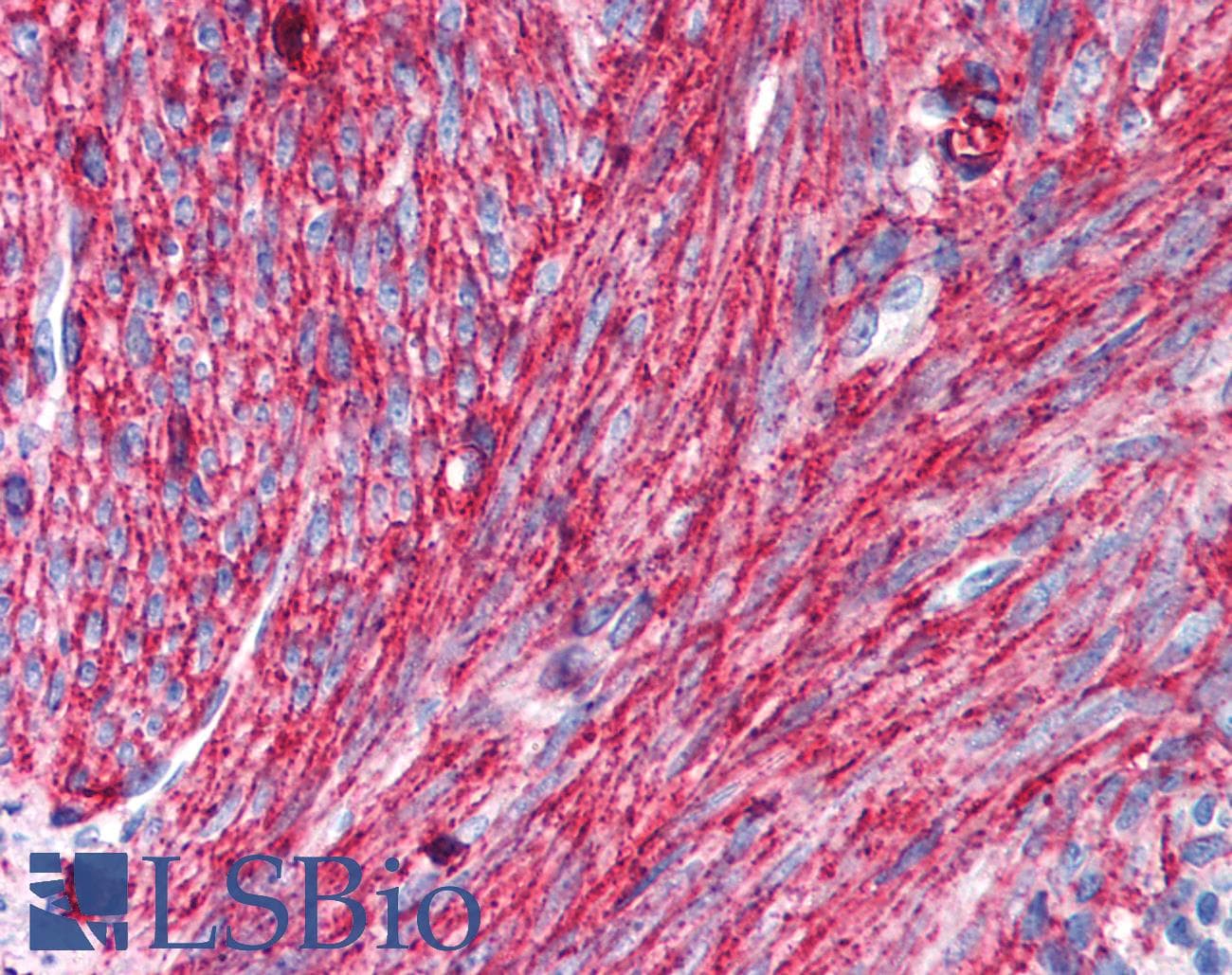 PathPlus™ CD44 Antibody (clone MEM-263)