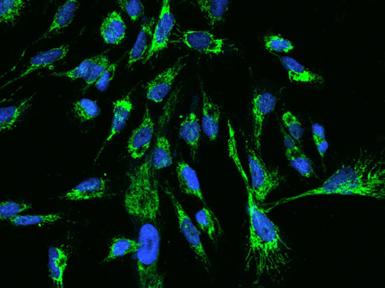 Polyclonal Rabbit anti-Human TTC19 Antibody (IF, WB)