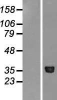 METAP1 Protein (Over-Expression Lysate Myc-DDK (Flag))
