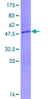 Human RNF135 Protein (Recombinant GST)