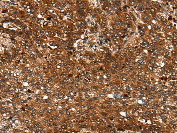 CDKL4 Antibody