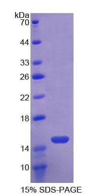 Mouse TLR3 Protein (Recombinant His)