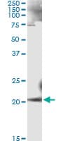 Monoclonal Mouse anti-Human ANK1 / Ankyrin Antibody (clone 3C3)
