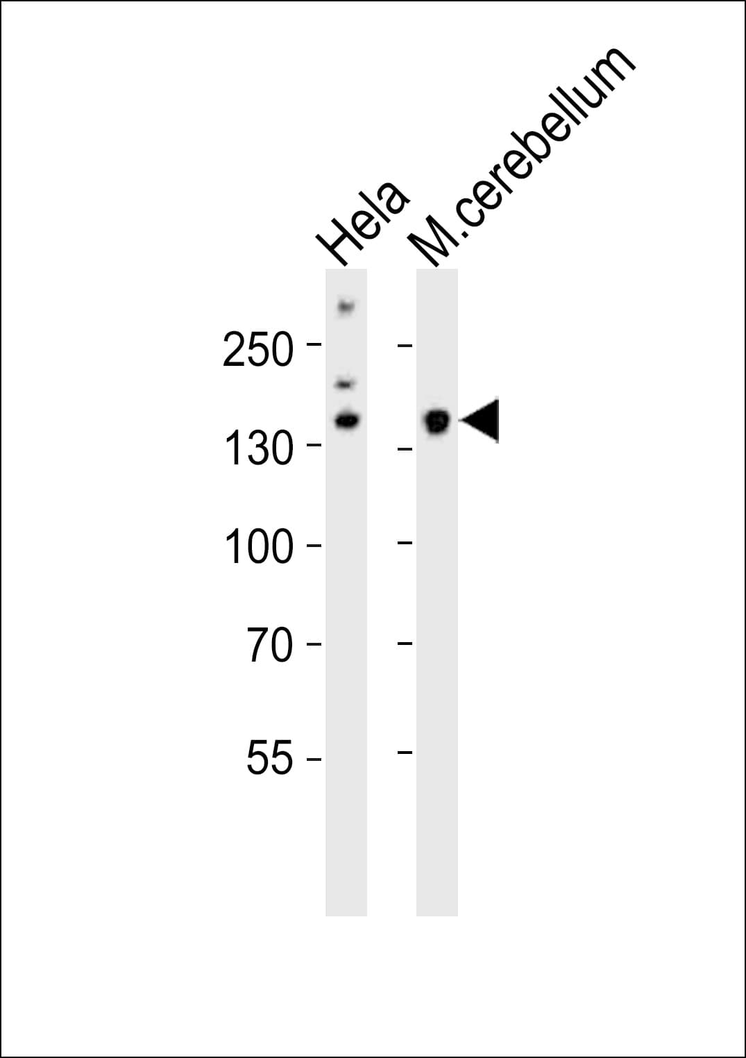 KDM6B / JMJD3 Antibody (aa1023-1057)