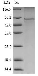Mouse VRK1 Protein (Recombinant 10His, N-terminus + Myc, C-terminus)