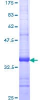Human BACE2 Protein (Recombinant GST, N-terminus)