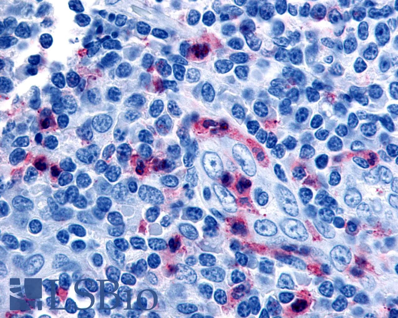 PathPlus™ Polyclonal Rabbit anti-Human GPR65 / TDAG8 Antibody (Cytoplasmic Domain, IHC)