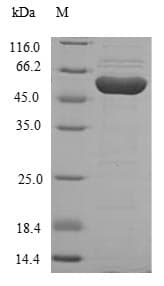 Human HGD Protein (Recombinant 6His, N-terminus)