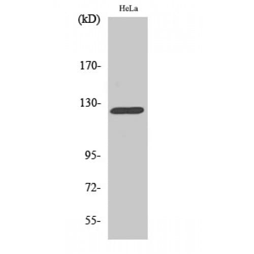 NEP / DDR1 Antibody (260-340 aa, Internal)