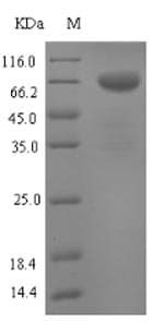 Mouse TPH1 / Tryptophan Hydroxylase Protein (Recombinant 6His-SUMO, N-terminus)