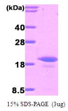 Human IL16 Protein (Recombinant His)