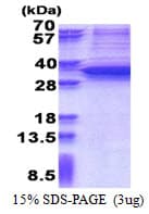 Human SNAI1 / SNAIL-1 Protein (Recombinant His)