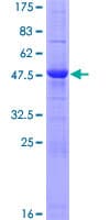 Human CTHRC1 Protein (Recombinant GST)