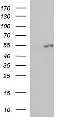 FGG / Fibrinogen Gamma Antibody (clone OTI1F5, Carrier-free)