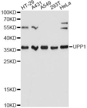 Polyclonal Rabbit anti-Human UP / UPP1 Antibody (WB)