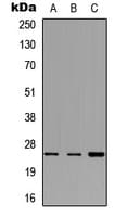 CD79B / CD79 Beta Antibody (Internal)