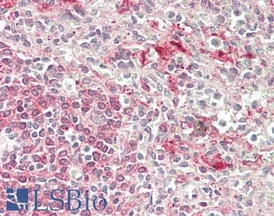 Polyclonal Rabbit anti-Human CNDP2 Antibody (HRP, IHC, WB)