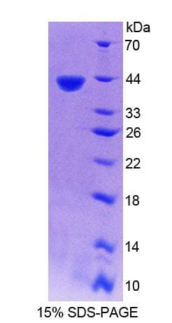 Human JMJD6 / PSR Protein (Recombinant His-T7)