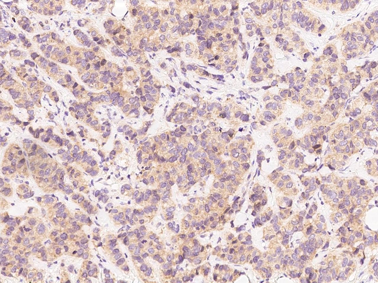 BECN1 / Beclin-1 Antibody (Preservative Free)