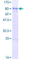 Human TBCD Protein (Recombinant GST)