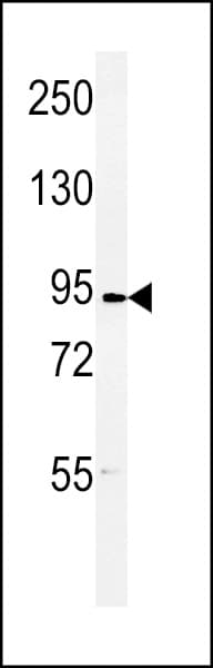 HURP / DLGAP5 Antibody (aa228-258)