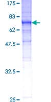 Human TUBB3 / Tubulin Beta 3 Protein (Recombinant GST)