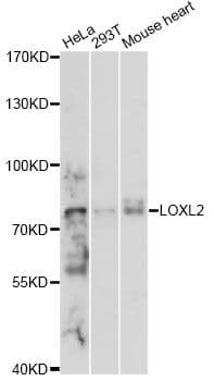 Polyclonal Rabbit anti-Human LOXL2 Antibody (WB)