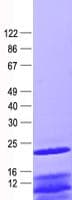 Human BAD Protein (Recombinant His, N-Terminal)