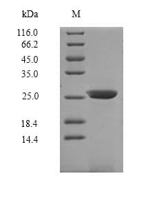 Mouse IL7R / CD127 Protein (Recombinant 6His, N-terminus)