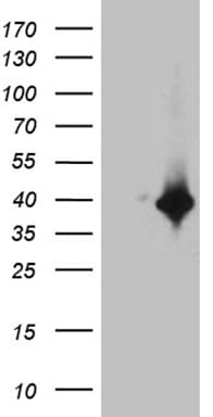 DTWD1 Antibody (clone OTI2D2)
