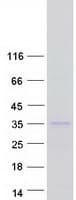 Human KCNIP2 / KCHIP2 Protein (Recombinant Myc-DDK (Flag))