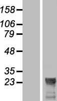 LOC285908 Protein (Over-Expression Lysate Myc-DDK (Flag))