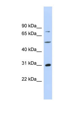 Polyclonal Rabbit anti-Human Junctin / ASPH Antibody (aa287-336, WB)