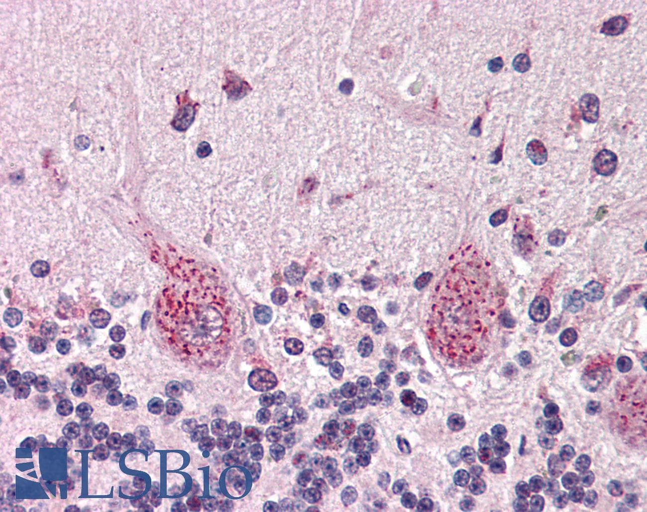 IHC-plus™ RBL2 / RB2 p130 Antibody (C-Terminus)