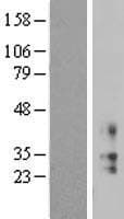 KCNMB2 Protein (Over-Expression Lysate Myc-DDK (Flag))
