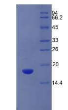 Human SLC3A2 / CD98 Heavy Chain Protein (Recombinant His)