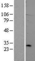 TREM2 / TREM-2 Protein (Over-Expression Lysate Myc-DDK (Flag))