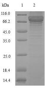 Crimean-Congo hemorrhagic fever virus SARS-CoV Nucleoprotein (Recombinant 6His-B2M, N-terminus)