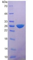 Rat MYHC / MYH6 Protein (Recombinant His)