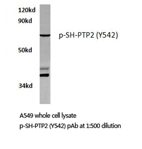 Polyclonal Rabbit anti-Human PTPN11 / SHP-2 / NS1 Antibody (Tyr542, IHC, WB)