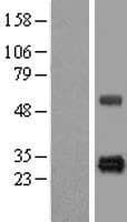 HSCB Protein (Over-Expression Lysate Myc-DDK (Flag))